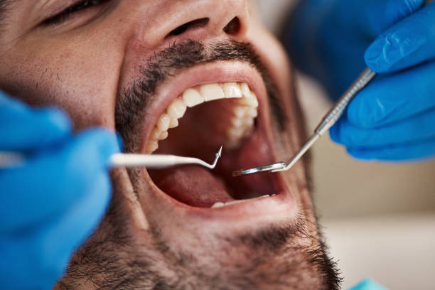 Best Dental Abscess Treatment in Murphy, NC
