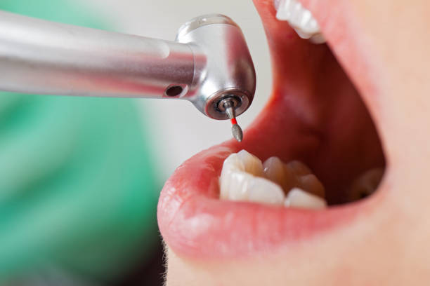Best Weekend Emergency Dental Services in Murphy, NC